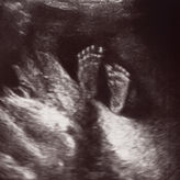 Klare Rahmenbedingungen für vorgeburtliche Diagnostik gefordert